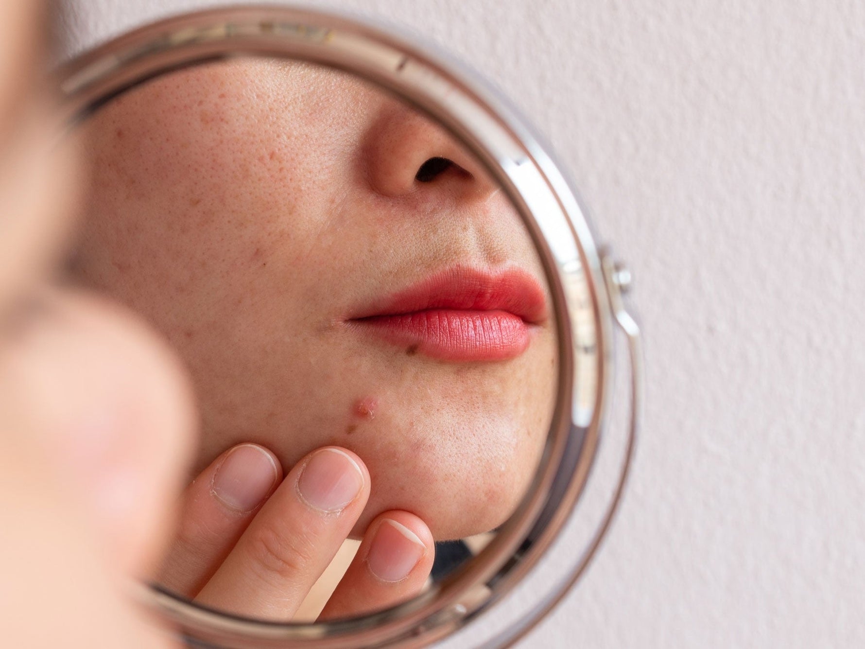 Dark Spots & Melasma in Egypt: Why Your Skin Is More Prone and How to Actually Treat Them